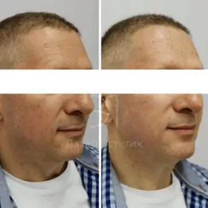 Мужская косметология